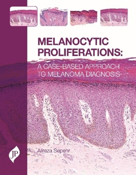 Hardcover Melanocytic Proliferations: A Case-Based Approach to Melanoma Diagnosis Book