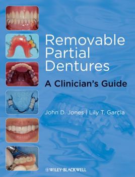 Paperback Removable Partial Dentures: A Clinician's Guide Book