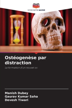Ostéogenèse par distraction (French Edition)