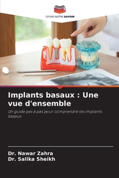 Paperback Implants basaux: Une vue d'ensemble [French] Book