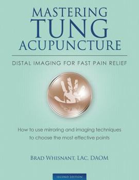 Paperback Mastering Tung Acupuncture - Distal Imaging for Fast Pain Relief: 2nd Edition Book