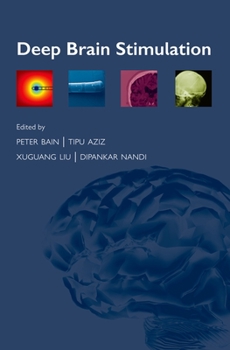 Paperback Deep Brain Stimulation Book