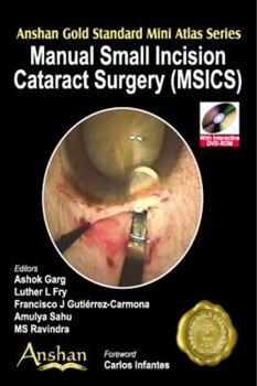 Paperback Manual Small Incision Cataract Surgery (Msics) Book