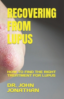 Paperback Recovering from Lupus: How to Find the Right Treatment for Lupus Book