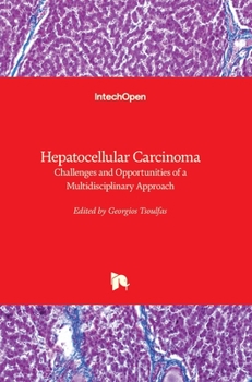 Hardcover Hepatocellular Carcinoma: Challenges and Opportunities of a Multidisciplinary Approach Book