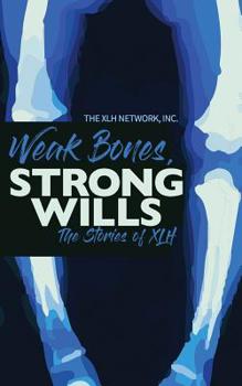 Paperback Weak Bones, Strong Wills: The Stories of XLH Book