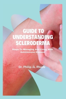 Paperback Guide to Understanding Scleroderma: Steps to managing and living with autoimmune disease Book