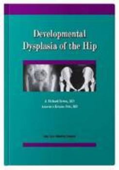 Paperback Developmental Dysplasia of the Hip Book
