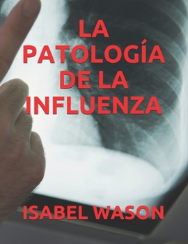 LA PATOLOGÍA DE LA INFLUENZA (Spanish Edition)