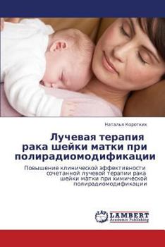 Paperback Luchevaya Terapiya Raka Sheyki Matki Pri Poliradiomodifikatsii [Russian] Book