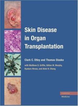 Hardcover Skin Disease in Organ Transplantation Book