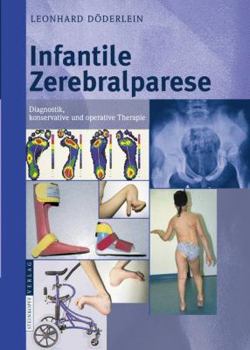 Hardcover Infantile Zerebralparese: Diagnostik, Konservative Und Operative Therapie [German] Book