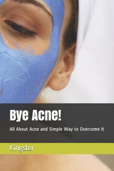 Paperback Bye Acne!: All about Acne and Simple Way to Overcome It Book