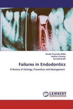 Paperback Failures in Endodontics Book
