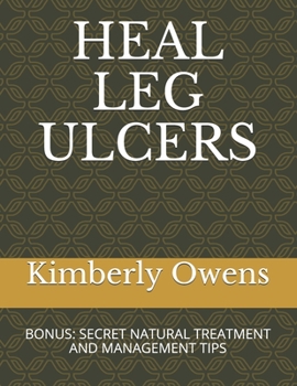 Paperback Heal Leg Ulcers: Bonus: Secret Natural Treatment and Management Tips Book