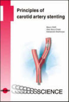 Hardcover Principles of Carotid Artery Stenting (Uni-Med Science) Book