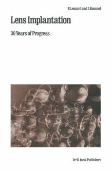 Paperback Lens Implantation: 30 Years of Progress Book