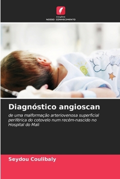 Paperback Diagnóstico angioscan [Portuguese] Book
