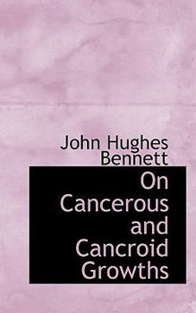 Paperback On Cancerous and Cancroid Growths Book