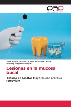 Paperback Lesiones en la mucosa bucal [Spanish] Book