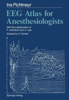 Paperback Eeg Atlas for Anesthesiologists Book