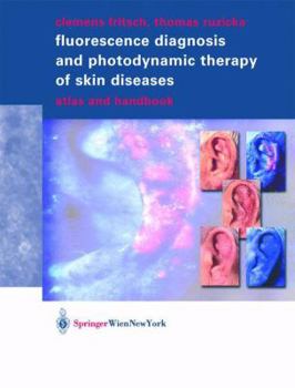 Paperback Fluorescence Diagnosis and Photodynamic Therapy of Skin Diseases: Atlas and Handbook Book