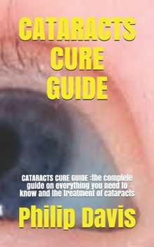 Paperback Cataracts Cure Guide: CATARACTS CURE GUIDE: the complete guide on everything you need to know and the treatment of cataracts Book