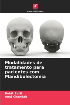 Paperback Modalidades de tratamento para pacientes com Mandibulectomia [Portuguese] Book