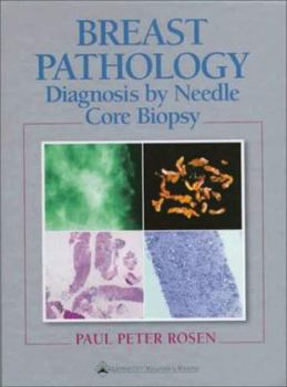 Hardcover Breast Pathology: Diagnosis by Needle Core Biopsy Book