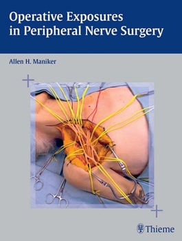Hardcover Operative Exposures in Peripheral Nerve Surgery Book