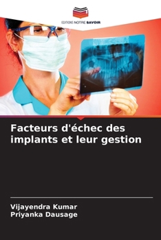 Facteurs d'échec des implants et leur gestion (French Edition)