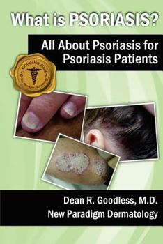 Paperback What is Psoriasis?: All About Psoriasis for Psoriasis Patients Book