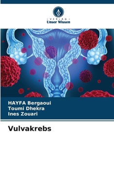 Paperback Vulvakrebs [German] Book