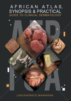 Paperback African Atlas, Synopsis & Practical Guide to Clinical Dermatology Book