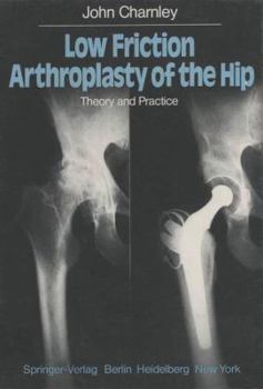 Hardcover Low Friction Arthroplasty of the Hip: Theory and Practice Book