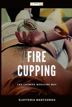 Paperback Fire Cupping: The Chinese Medicine Way Book
