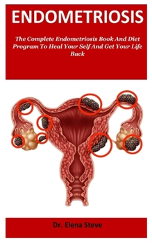 Paperback Endometriosis: The Complete Endometriosis Book And Diet Program To Heal Your Self And Get Your Life Back Book