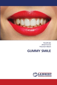 Paperback Gummy Smile Book