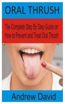 Paperback Oral Thrush: The Complete Step By Step Guide on How to Prevent and Treat Oral Thrush Book