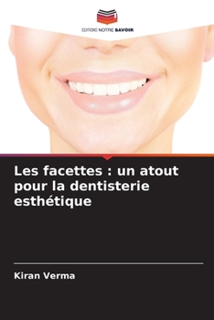 Paperback Les facettes: un atout pour la dentisterie esthétique [French] Book