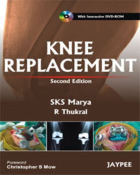 Hardcover Knee Replacement [with DVD Rom] [With DVD ROM] Book