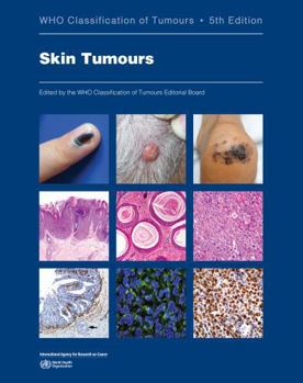 Paperback Skin Tumours: Who Classification of Tumours Book