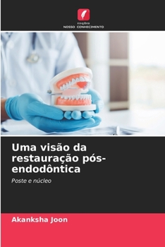 Paperback Uma visão da restauração pós-endodôntica [Portuguese] Book