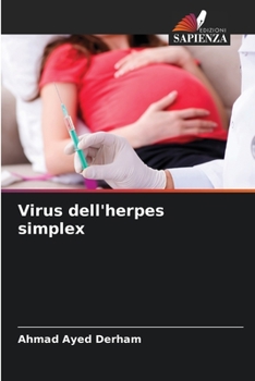 Paperback Virus dell'herpes simplex [Italian] Book