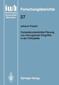 Computerunterstutzte Planung von chirurgischen Eingriffen in der Orthopadie (IWB Forschungsberichte)