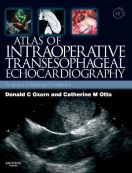 Hardcover Atlas of Intraoperative Transesophageal Echocardiography: Surgical and Radiologic Correlations, Text with DVD [With DVD] Book