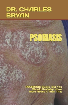 Paperback Psoriasis: PSORIASIS Sucks. But You Should Probably Know More About It Than That Book