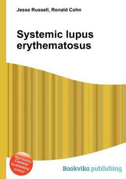 Paperback Systemic Lupus Erythematosus Book