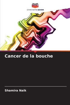 Paperback Cancer de la bouche [French] Book