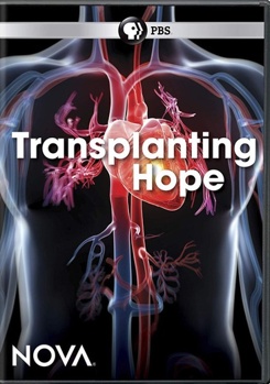 DVD Nova: Transplanting Hope Book
